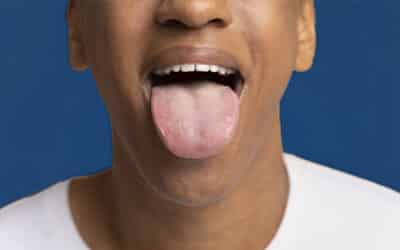 Какую роль играет микробиота полости рта в вашем здоровье?